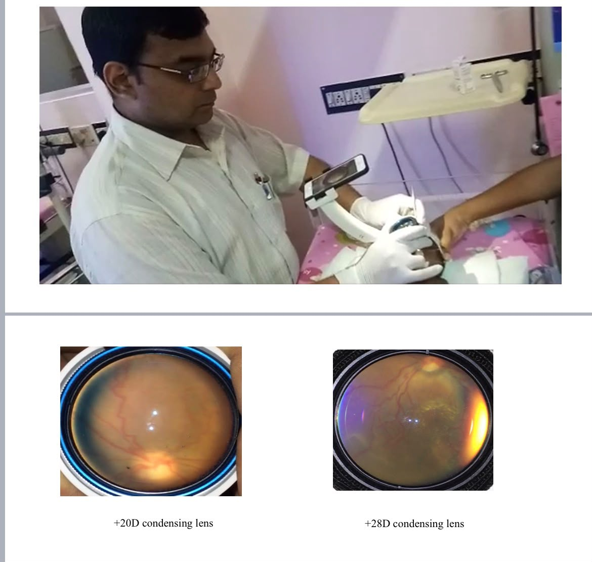 Dr. Anubhav Giridhar performing a neonatal eye scan with an MII device at Giridhar Eye Institute, Kochi