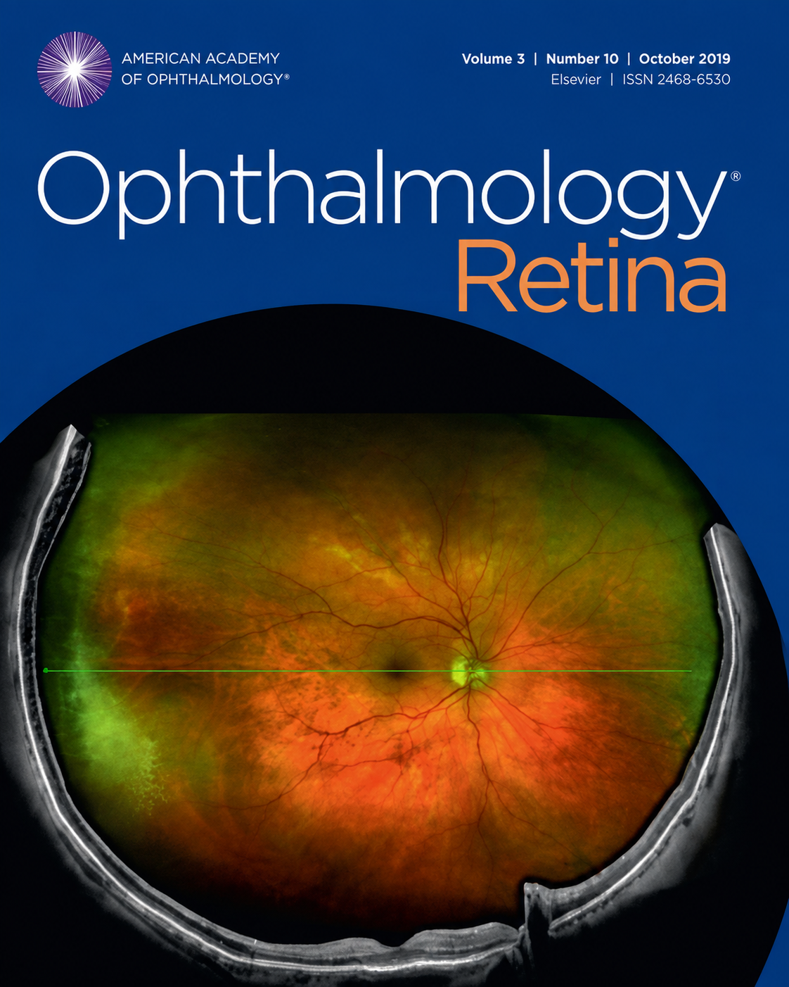 Comparison of a Smartphone-Based Photography Method with Indirect Ophthalmoscopic Assessment in Referable ROP
